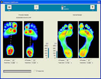 Comparing Pronated Foot with Normal Foot