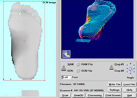Foot Laser Scan - Computer Software