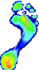Picture showing scanned foot with areas of high pressure