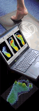 TOG Gaitscan and computer screen, foot computerised gait analysis equipment