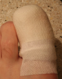 Ingrowing toenail dressing